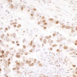 KAP1, p Ser824 Antibody (BL-246-7B5), Novus Biologicals 100 &mu;L | Buy Online | Novus Biologicals | Fisher Scientific